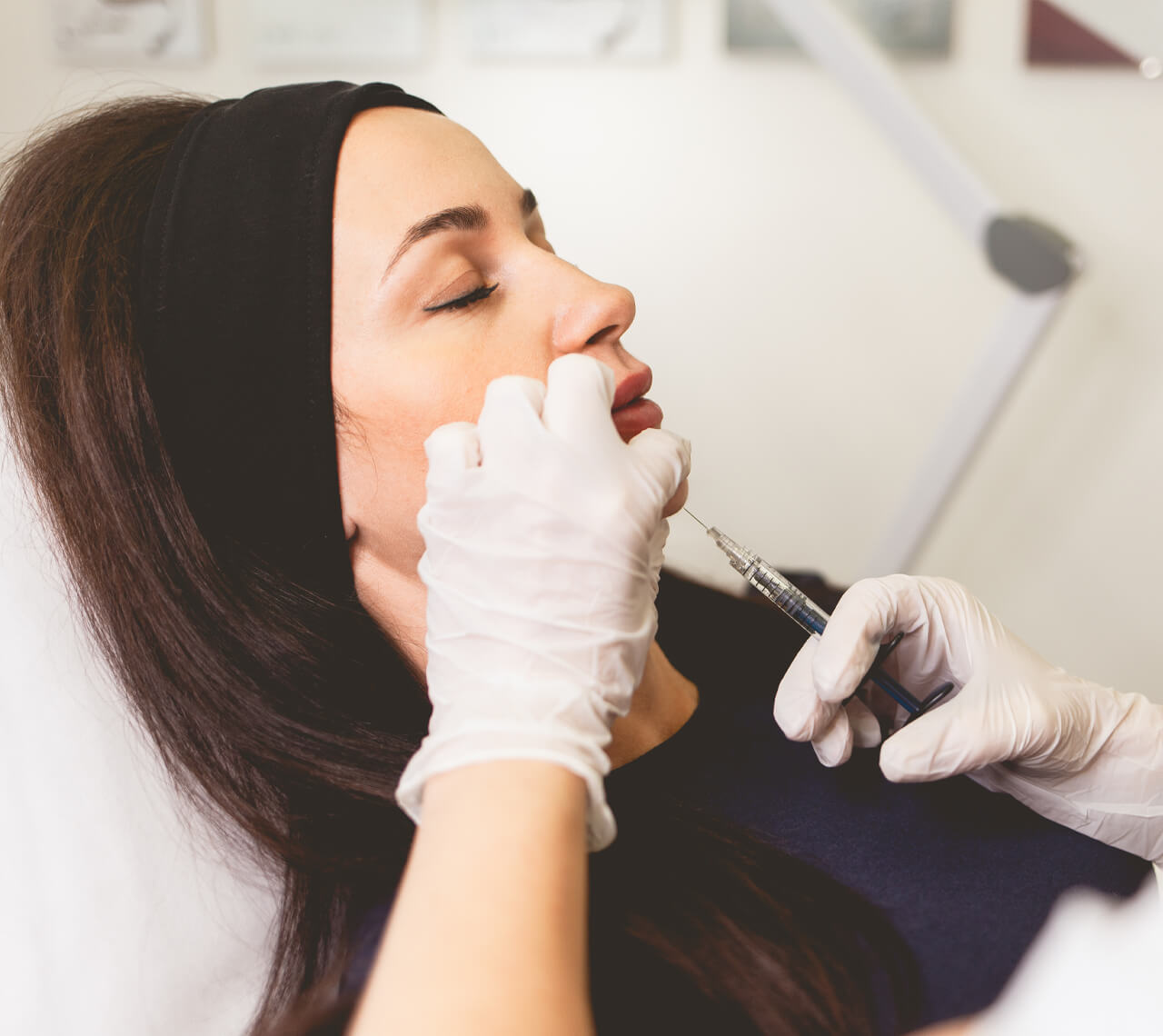 dermal filler