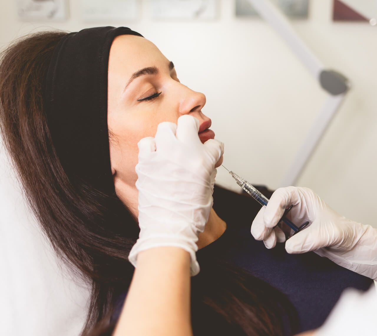 dermal filler